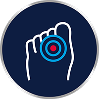 Jeukende, brandende plekken tussen de tenen?